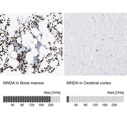 MNDA Antibody, Novus Biologicals:Antikroppar:Primära antikroppar
